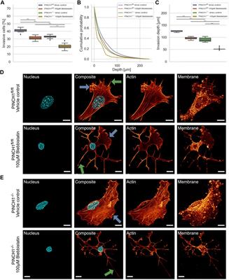 PINCH1 Promotes Fibroblast Migration in Extracellular Matrices and Influences Their Mechanophenotype